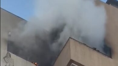 Segundo HUOP, jovem vítima de queimaduras em edifício no Country está na UTI